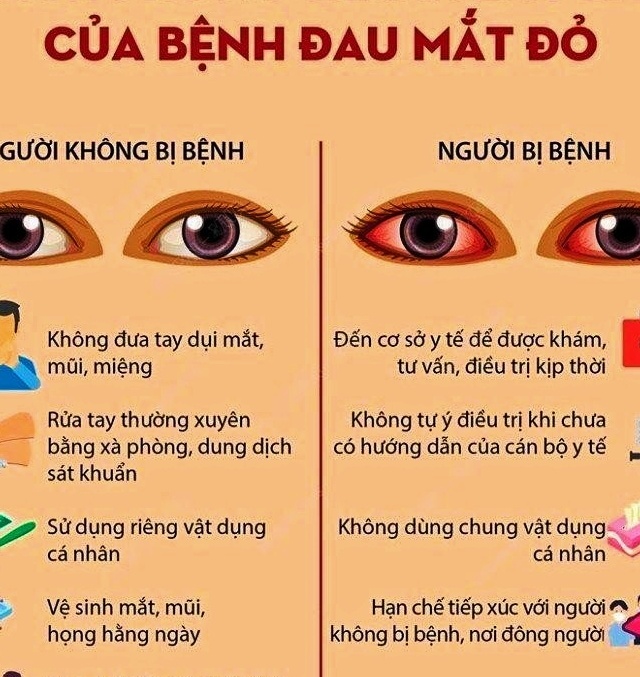 Thái Bình: Tăng cường các biện pháp phòng, chống bệnh đau mắt đỏ