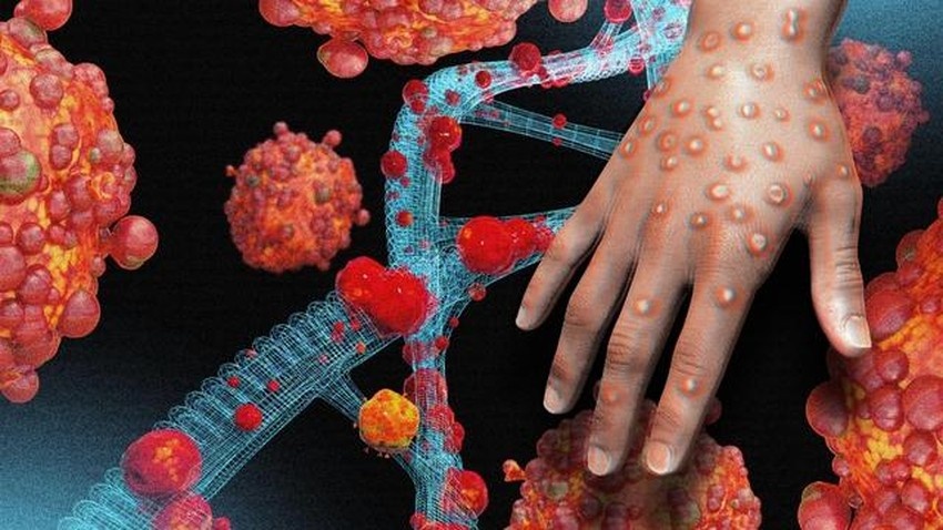 WHO ban bố tình trạng khẩn cấp về sức khỏe vì đậu mùa khỉ