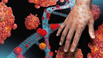 who ban bo tinh trang khan cap ve suc khoe vi dau mua khi