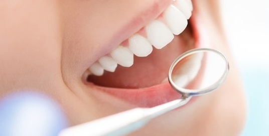 6 dấu hiệu của bệnh sâu răng cần lưu ý
