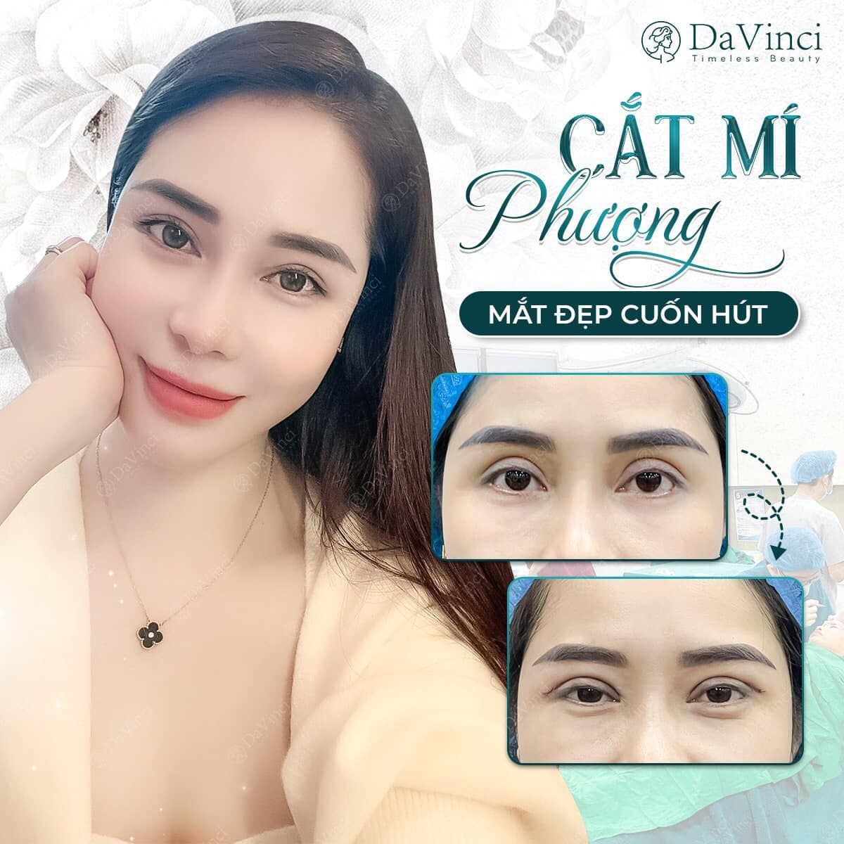Thẩm mỹ DaVinci Hồ Chí Minh được cấp phép những dịch vụ gì ? Thẩm mỹ DaVinci Hồ Chí Minh được cấp phép những dịch vụ gì ?