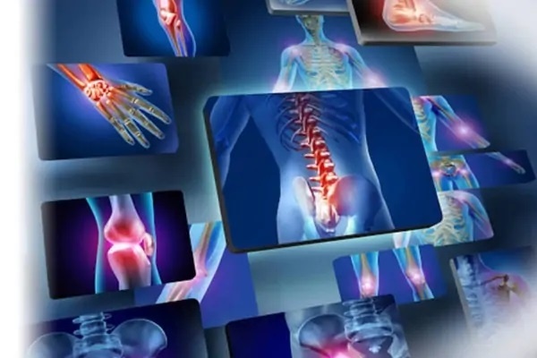 Phòng ngừa nguy cơ bệnh cơ xương khớp