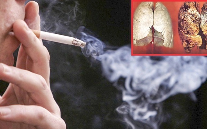 Cần cấm hoàn toàn sử dụng thuốc lá mới và tăng thuế sản xuất kinh doanh thuốc lá Cần cấm hoàn toàn sử dụng thuốc lá mới và tăng thuế sản xuất kinh doanh thuốc lá