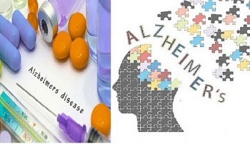 thuoc moi trong dieu tri alzheimer