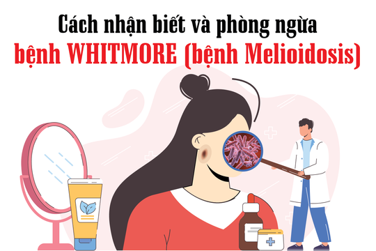 Phòng chống vi khuẩn “ăn thịt người” gây bệnh Whitmore