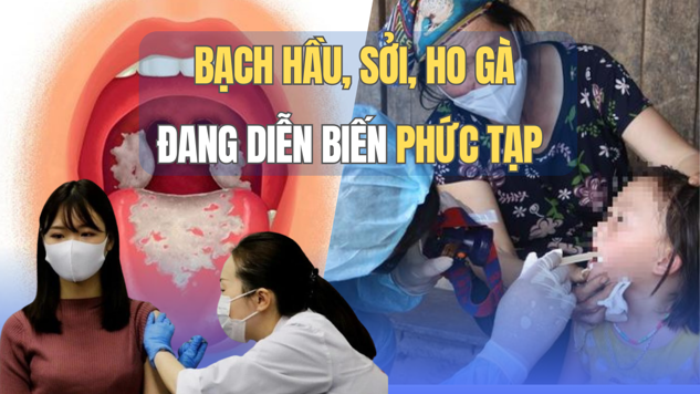 benh soi ho ga dang dien bien phuc tap