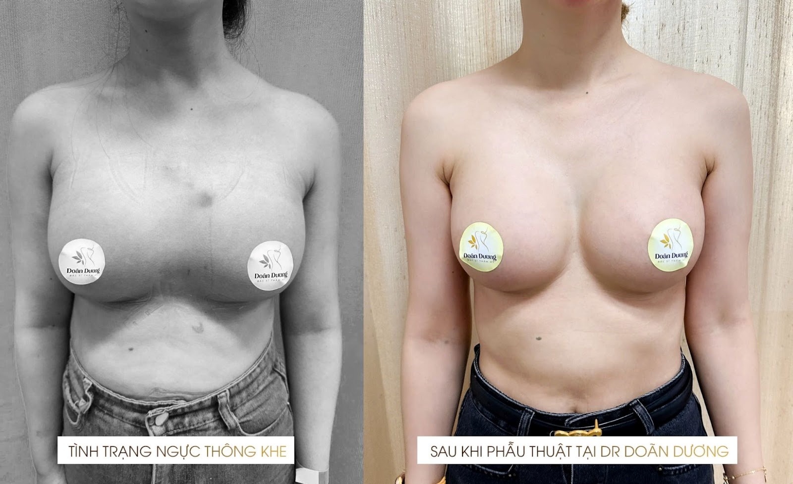 Thạc sĩ - Bác sĩ Ma Doãn Dương: “Bậc thầy giấu sẹo”