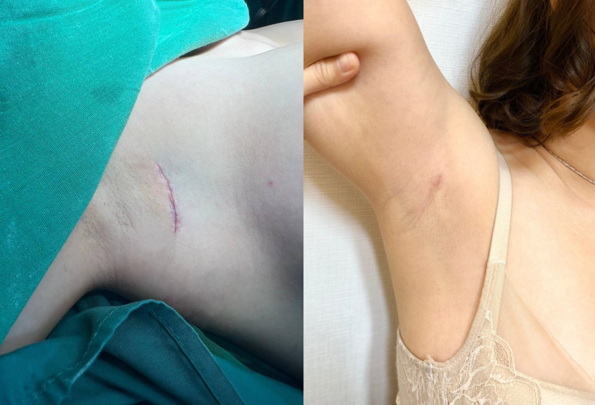 Thạc sĩ - Bác sĩ Ma Doãn Dương: “Bậc thầy giấu sẹo”