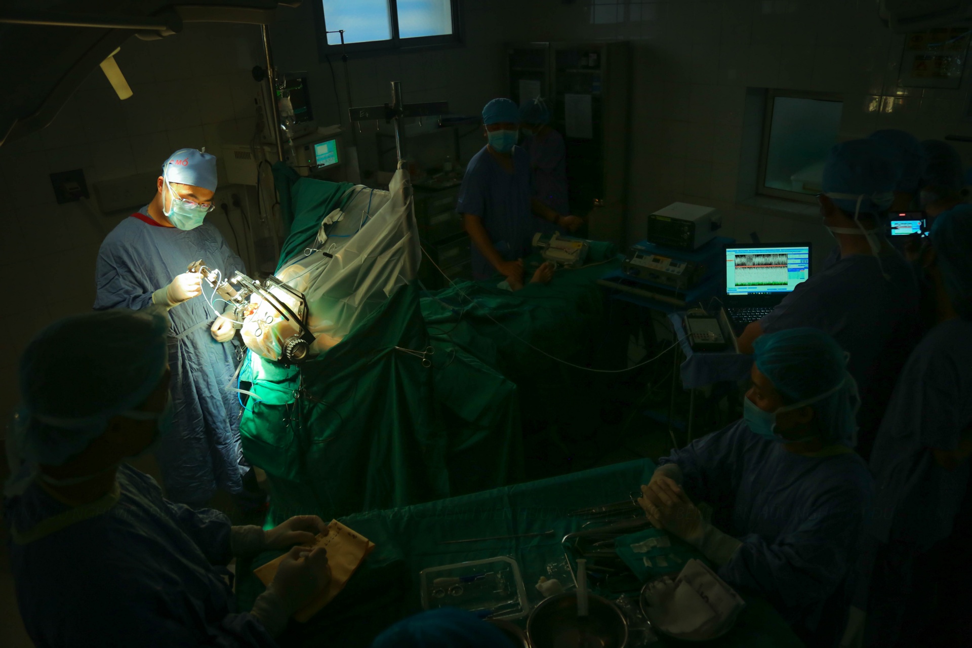 Phẫu thuật thành công cho bệnh nhân rối loạn trương lực cơ