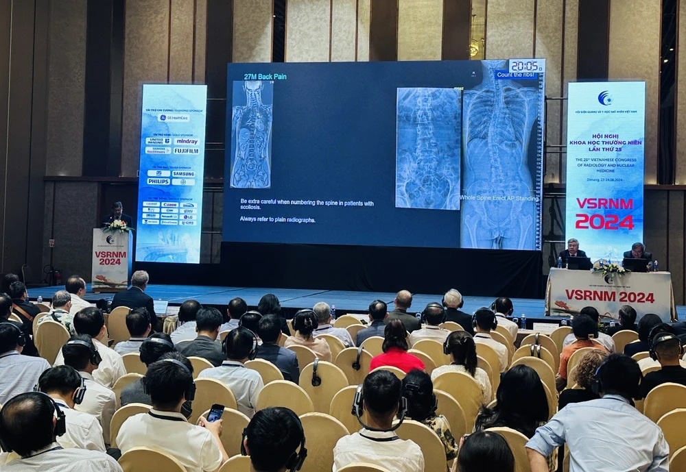 Ứng dụng AI trong chẩn đoán hình ảnh, siêu âm giúp bác sĩ giảm tải, người bệnh giảm chờ đợi kết quả