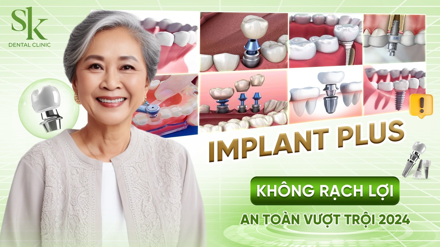 Trồng răng Implant không rạch lợi - kỹ thuật cấy ghép an toàn vượt trội năm 2024