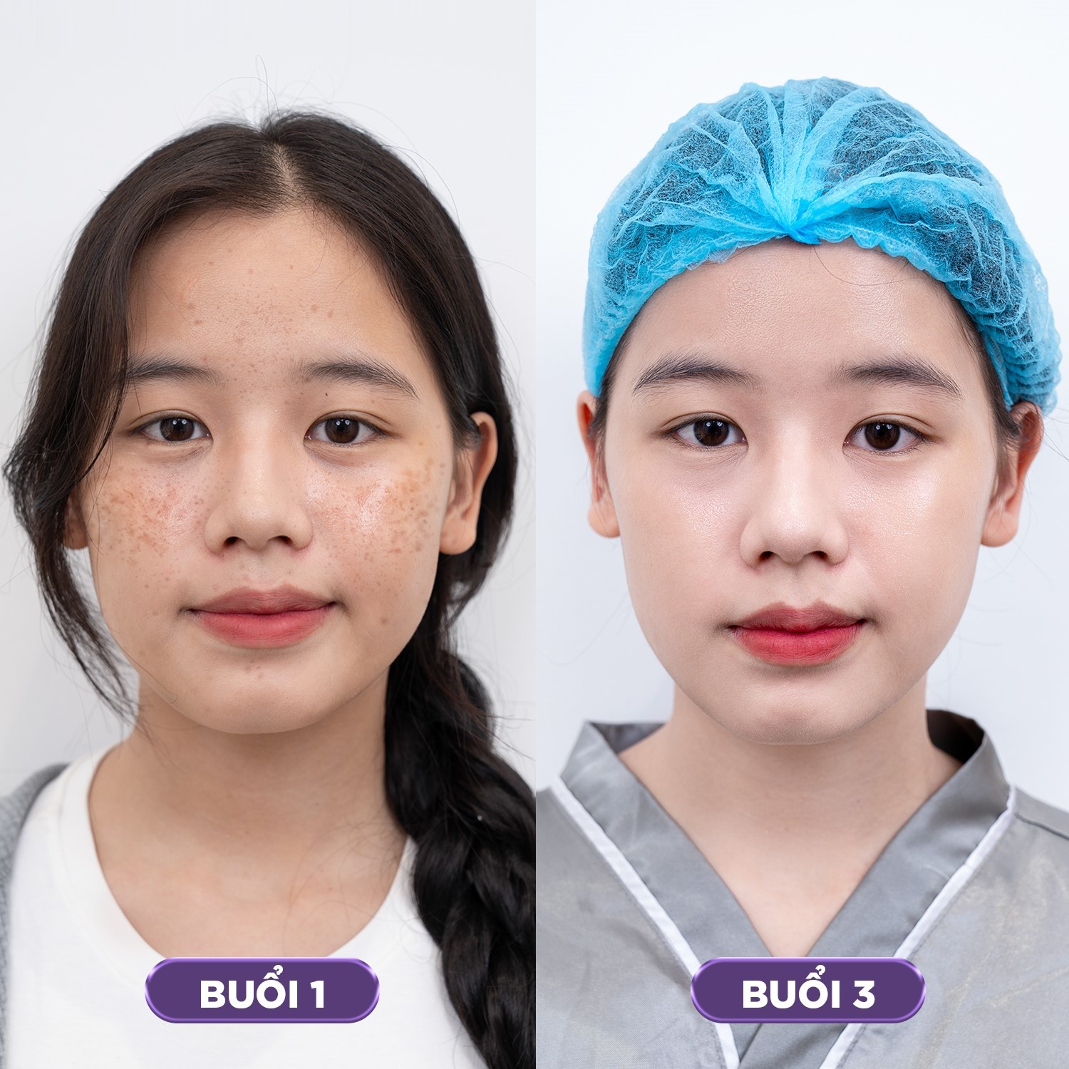 Bác sĩ Trà My giải bài toán “căng bóng da không xâm lấn” bằng công nghệ cao độc quyền Bác sĩ Trà My giải bài toán “căng bóng da không xâm lấn” bằng công nghệ cao độc quyền