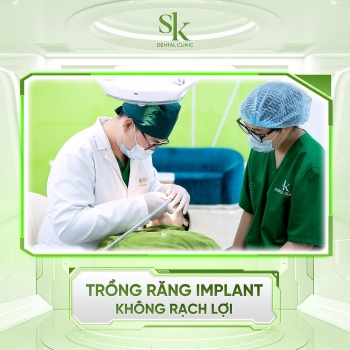 trong rang implant khong rach loi xu huong hot nhung khong phai bac si nao cung thuc hien duoc