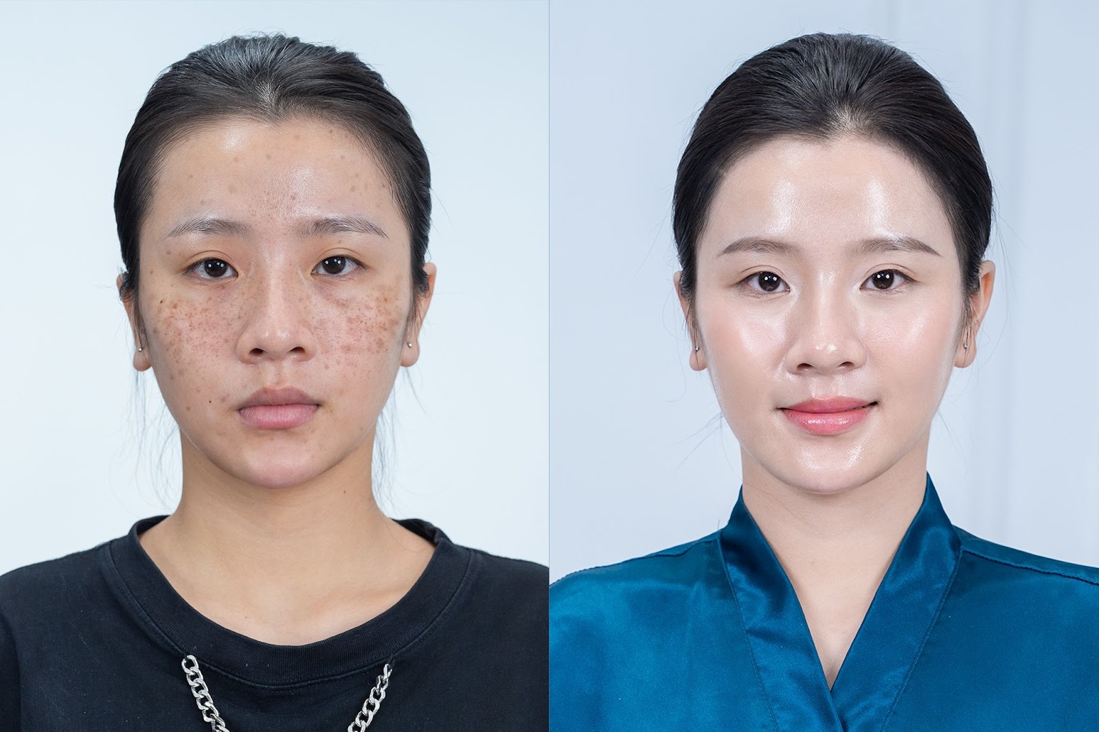 PGS.TS Phạm Hoàng Khâm tâm huyết với phương pháp Meso Extra không kim – mang lại thanh xuân cho phái đẹp