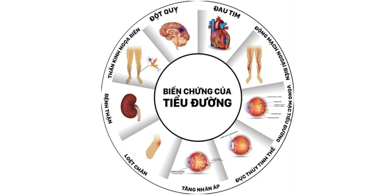 Bí quyết để tránh xa các biến chứng của bệnh tiểu đường