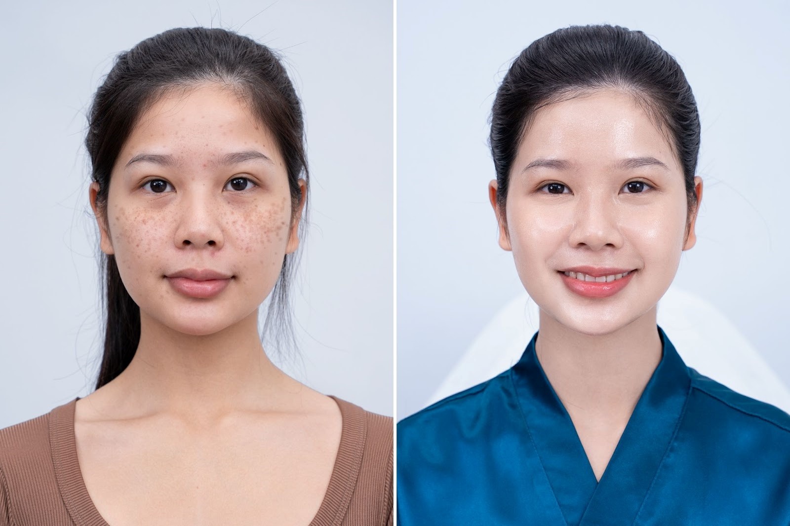 Đội ngũ bác sĩ da liễu đầu ngành tại Sun Beauty: Tiên phong trong kỷ nguyên làm đẹp không xâm lấn – tất cả vì khách hàng Đội ngũ bác sĩ da liễu đầu ngành tại Sun Beauty: Tiên phong trong kỷ nguyên làm đẹp không xâm lấn – tất cả vì khách hàng
