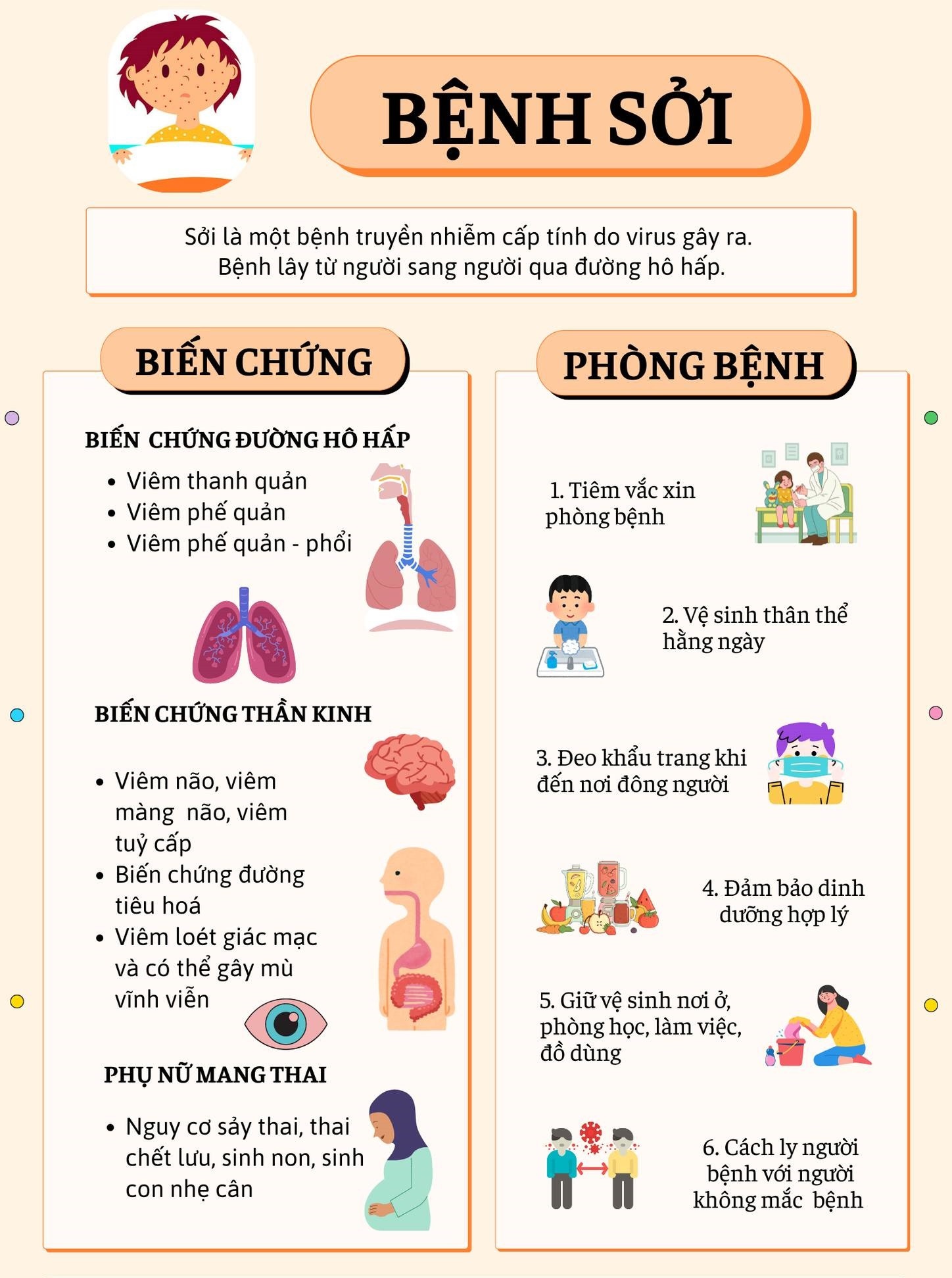 Tăng cường biện pháp phòng, chống bệnh sởi Tăng cường biện pháp phòng, chống bệnh sởi