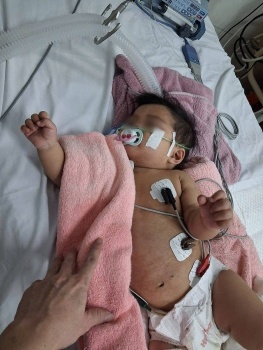 bvdk tinh khanh hoa cuu song benh nhi bi soi bien chung viem co tim cap