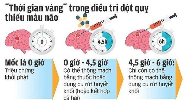 Giờ vàng” trong cấp cứu, điều trị bệnh nhân đột quỵ não.