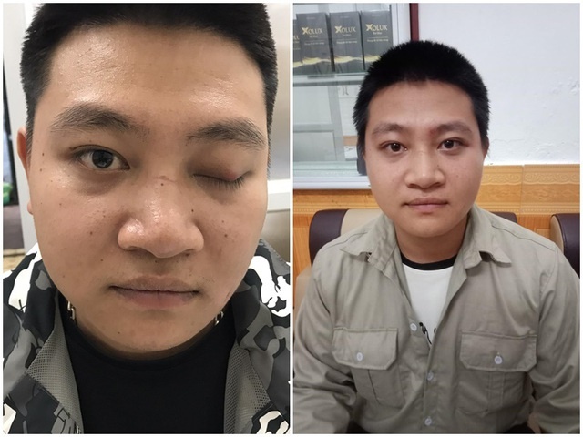 Bác sĩ Phạm Thị Thu Hà – người phục hồi thần kinh vận nhãn,  dây thần kinh 7,3