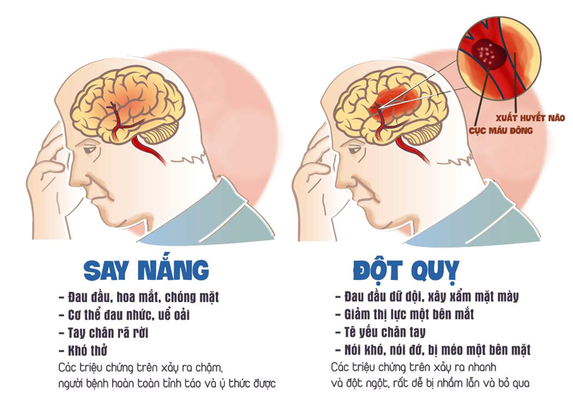 Phòng tránh đột quỵ khi thời tiết nắng nóng Phòng tránh đột quỵ khi thời tiết nắng nóng