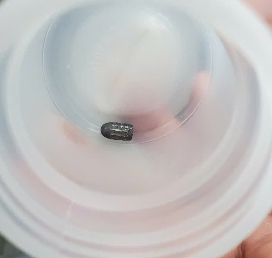 Phẫu thuật thành công một phụ nữ ở Cần Thơ bị đạn lạc trúng đầu khi đang làm vườn