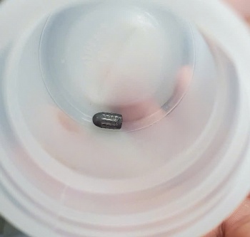 phau thuat thanh cong mot phu nu o can tho bi dan lac trung dau khi dang lam vuon