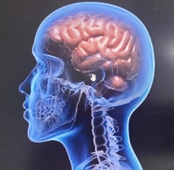 Dấu hiệu đột quỵ và cách xử lý, phòng ngừa