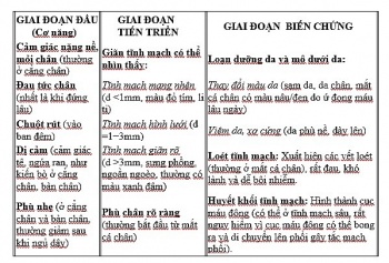 Bệnh giãn tĩnh mạch triệu chứng, chữa trị và phòng ngừa
