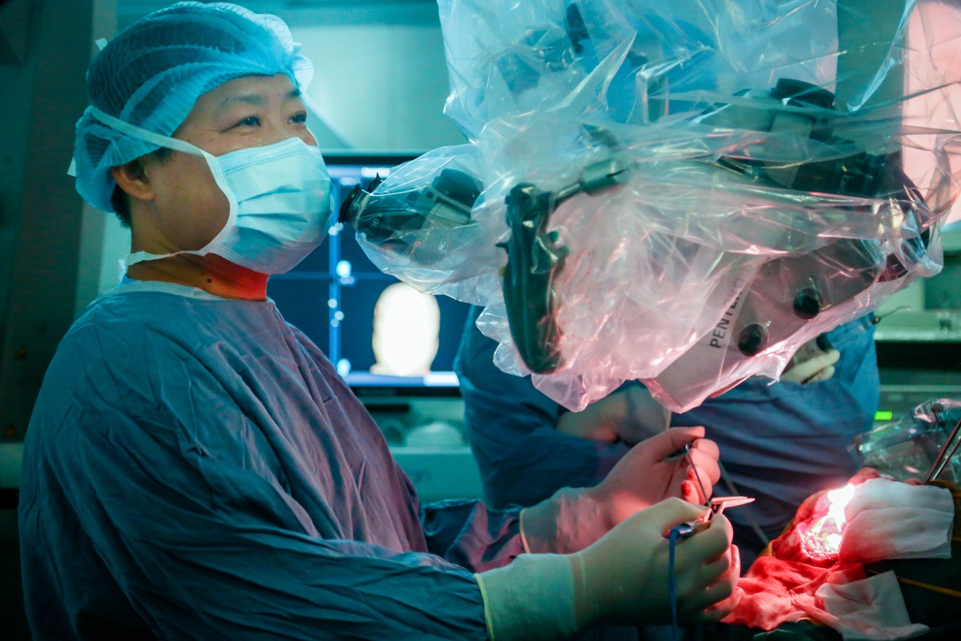   Sự kết hợp hoàn hỏa giữa 2 ekip phẫu thuật nhiều kinh nghiệm của BV Hữu nghị Việt Đức - Ảnh: VGP