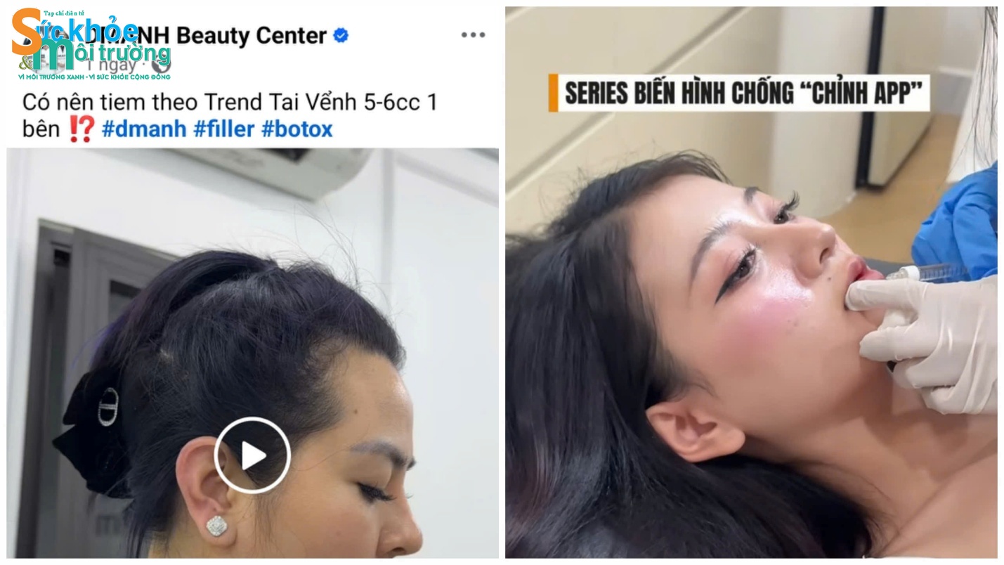 Dù đã bị cơ quan chức năng lập biên bản xử lý về vi phạm không phải cơ sở y tế được cấp phép từ 27/10, nhưng suốt những ngày qua trên trang Facebook và kênh Tiktok của Dmanh Beauty vẫn liên tục quảng cáo các dịch vụ không được cấp phép,… bất chấp quyết định đình chỉ hoạt động từ UBND phường Hà Đông. (Trong ảnh là video quảng cáo dịch vụ tiêm tai và tiêm môi trên trang Facebook Dmanh Beauty đăng tải vào đầu tháng 11).
