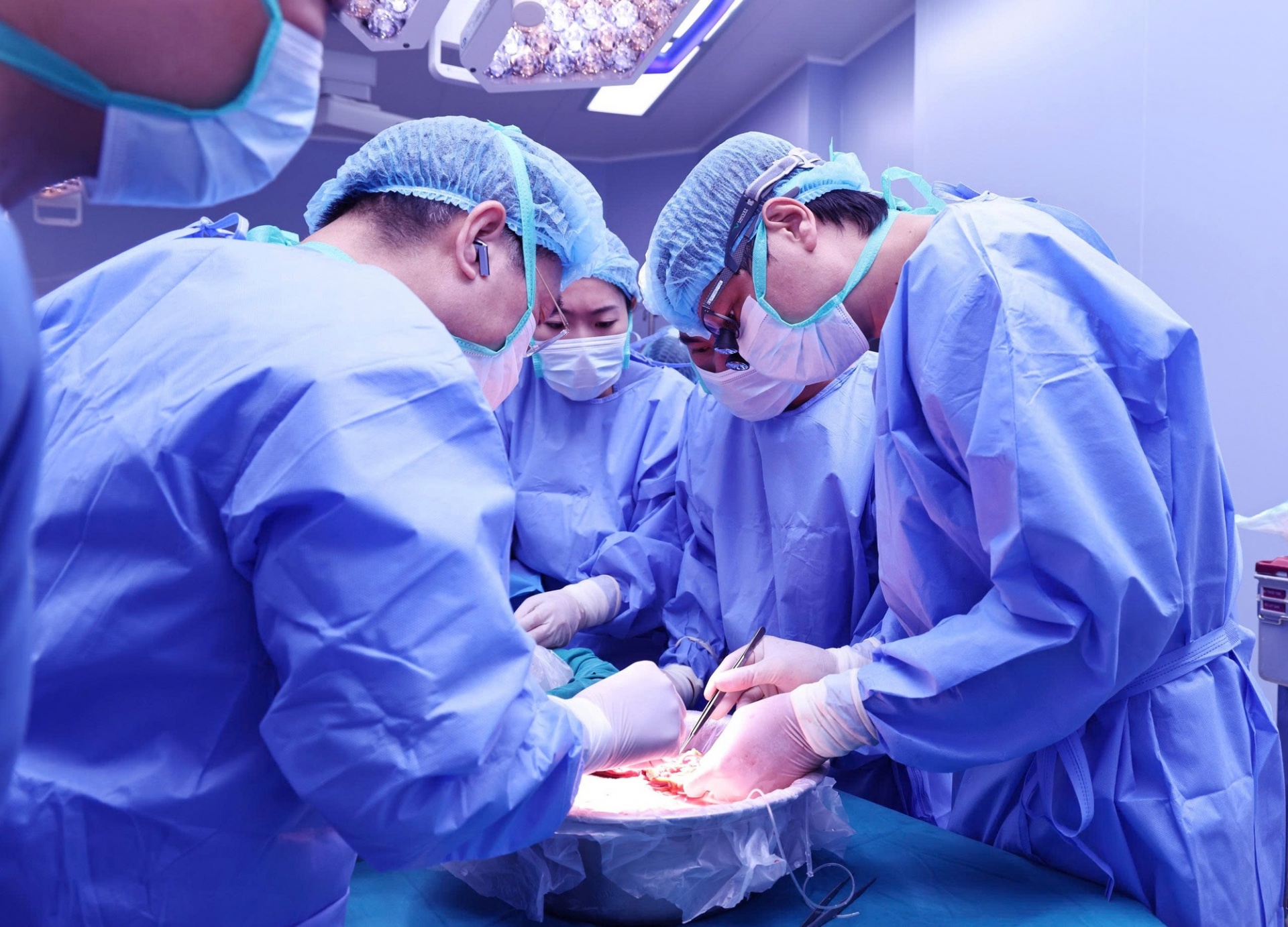 Các bác sĩ thực hiện kỹ thuật chia gan để ghép cho 2 ca bệnh hiểm nghèo - Ảnh: VGP Các bác sĩ thực hiện kỹ thuật chia gan để ghép cho 2 ca bệnh hiểm nghèo - Ảnh: VGP