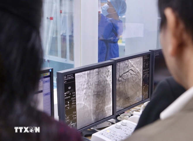   Các bác sỹ và chuyên gia trao đổi thực hiện can thiệp mạch vành cho bệnh nhân tại Bệnh viện 199. (Ảnh: Trần TTXVN)