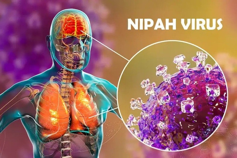   Để chủ động phòng chống bệnh do virus Nipal, người dân nên hạn chế đến khu vực đang có dịch nếu không thực sự cần thiết