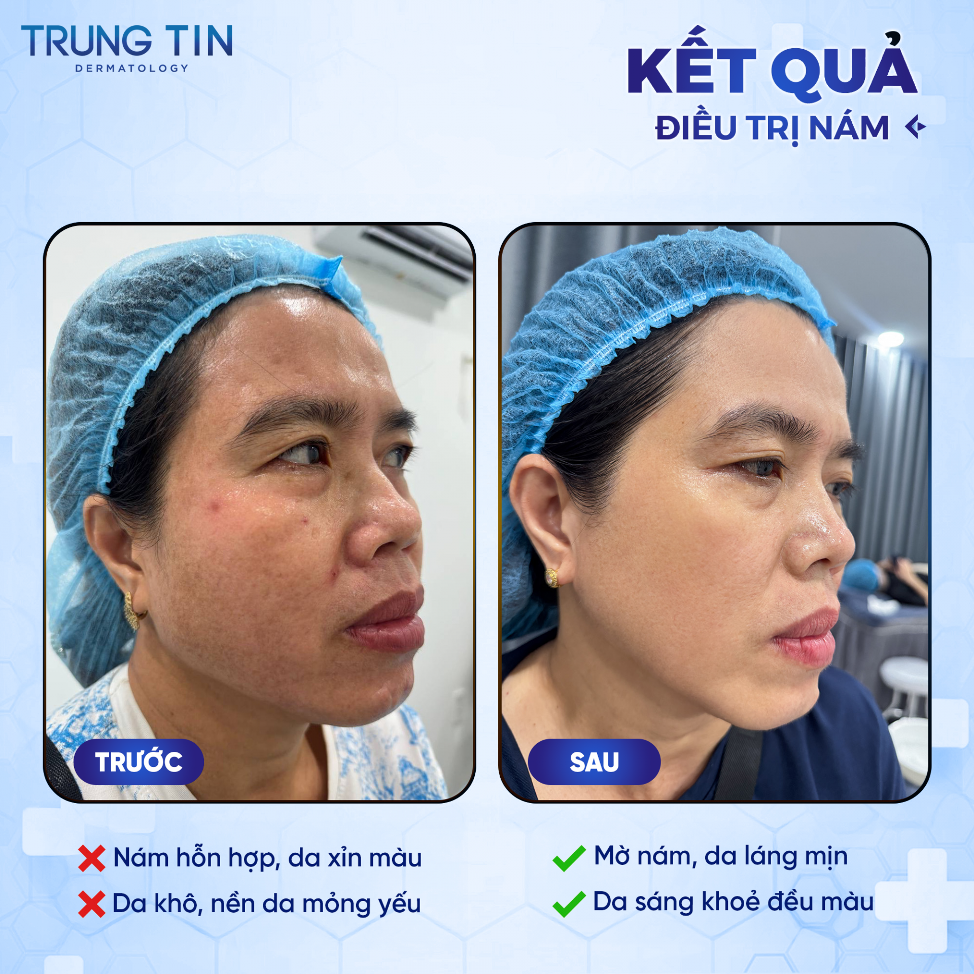 Phòng khám Da liễu Trung Tín nâng tầm chất lượng điều trị bằng chuyên môn và công nghệ hiện đại Phòng khám Da liễu Trung Tín nâng tầm chất lượng điều trị bằng chuyên môn và công nghệ hiện đại