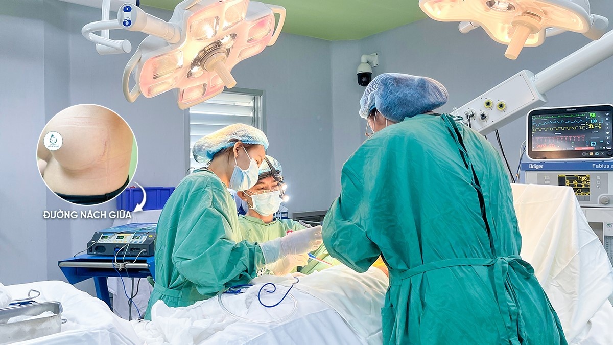 Xu hướng nâng ngực đường nách giữa: Giấu sẹo tinh tế, hồi phục nhanh chóng Xu hướng nâng ngực đường nách giữa: Giấu sẹo tinh tế, hồi phục nhanh chóng