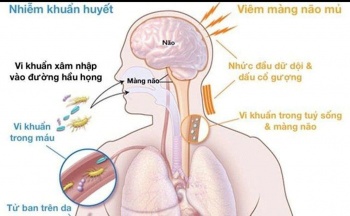 Cảnh báo nguy cơ gia tăng bệnh do não mô cầu: Chủ động phòng ngừa để bảo vệ sức khỏe cộng đồng