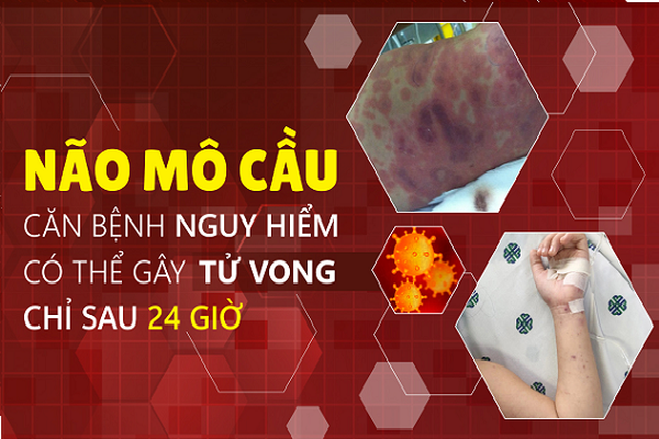 Bệnh não mô cầu nguy hiểm:  Đã có 4 ca tử vong, Viện Pasteur TP.HCM phát cảnh báo khẩn