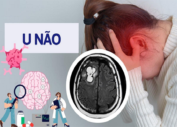 Người phụ nữ Campuchia vượt gần 1.000 km  sang Việt Nam mổ u não: Hành trình tìm lại sự sống