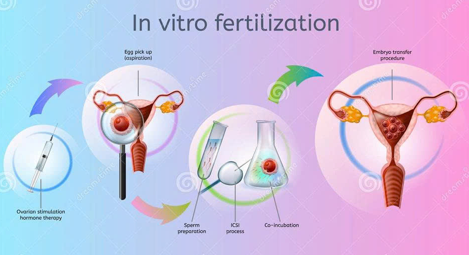 Mô phỏng quy trình thụ tinh trong ống nghiệm (IVF), mở ra hy vọng làm cha mẹ cho nhiều gia đình hiếm muộn. Mô phỏng quy trình thụ tinh trong ống nghiệm (IVF), mở ra hy vọng làm cha mẹ cho nhiều gia đình hiếm muộn.