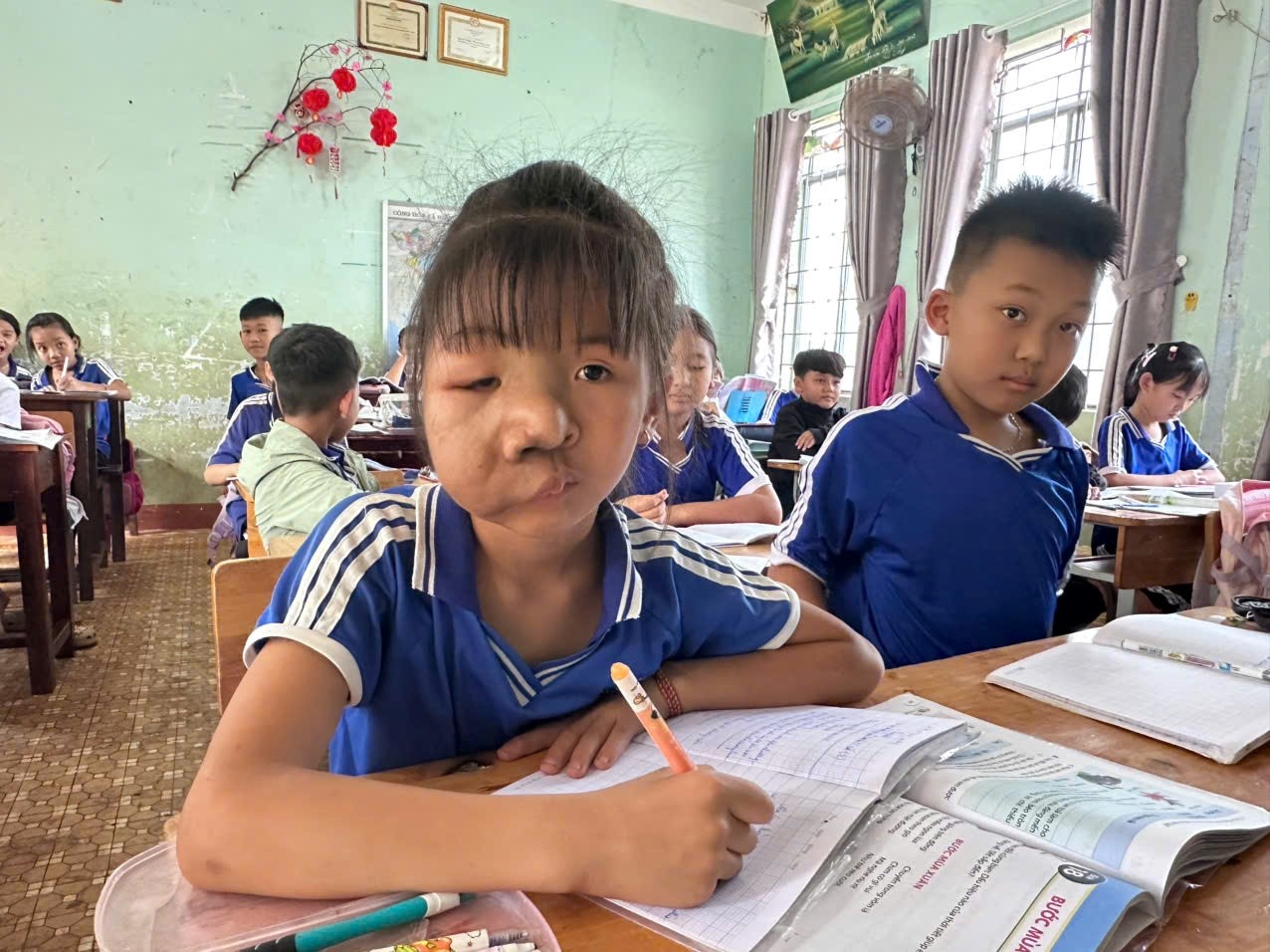  Dù mang khối u lớn trên khuôn mặt, em Nguyễn Ngọc Bảo Châu vẫn luôn cố gắng học tập và chăm chú nghe giảng trên lớp.