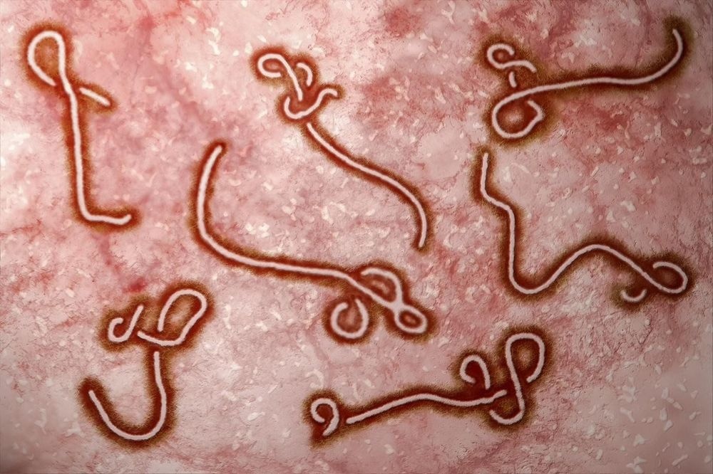Virus gây bệnh Ebola - Nguồn ảnh: thenativeantigencompany.com Virus gây bệnh Ebola - Nguồn ảnh: thenativeantigencompany.com