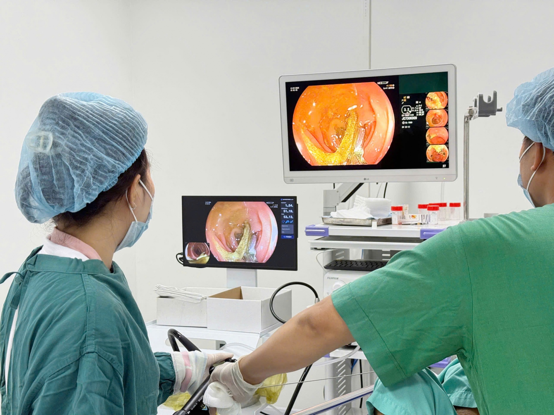 Bệnh viện 22-12: Nội soi thành công lấy túi nilon dài 20 cm trong ruột non của bệnh nhân Bệnh viện 22-12: Nội soi thành công lấy túi nilon dài 20 cm trong ruột non của bệnh nhân