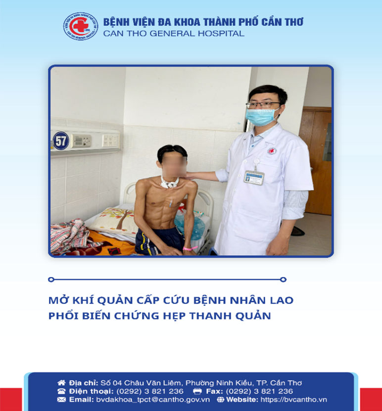 Cần Thơ: Cấp cứu thành công bệnh nhân lao phổi biến chứng hẹp thanh quản