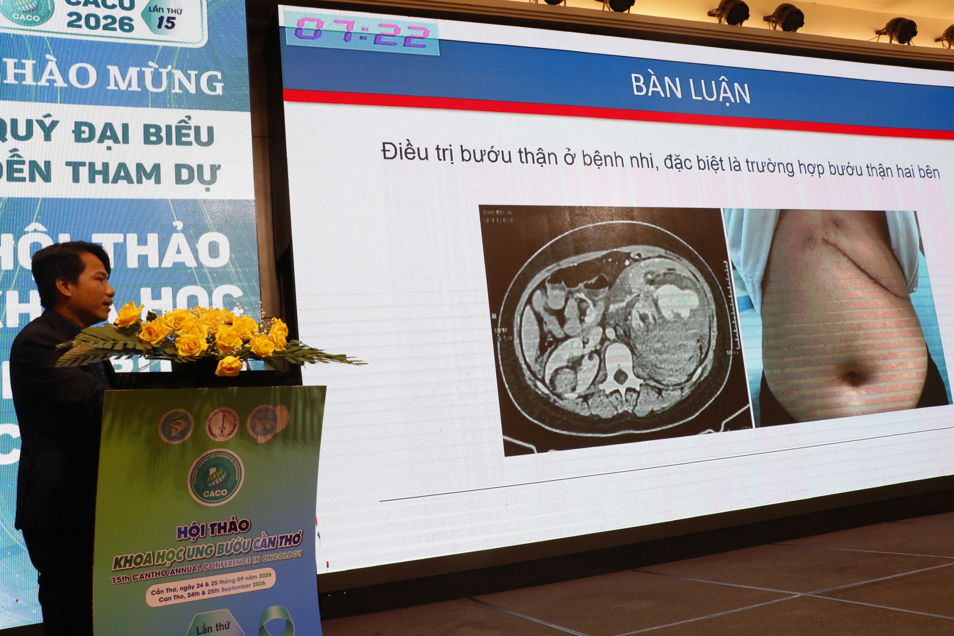 Nâng cao hiệu quả điều trị cho bệnh nhân ung thư Nâng cao hiệu quả điều trị cho bệnh nhân ung thư