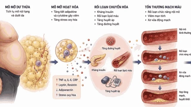 Béo phì là nguy cơ cao gây bệnh tim mạch