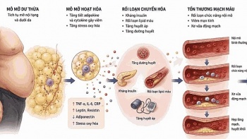 Béo phì là nguy cơ cao gây bệnh tim mạch