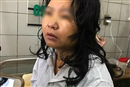 uong thuoc giam can nguoi phu nu 46 tuoi bi suy gan nguy kich