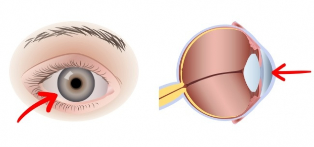 9 lợi ích tuyệt vời cho sức khỏe của bạn từ việc ăn 2 quả trứng gà mỗi ngày