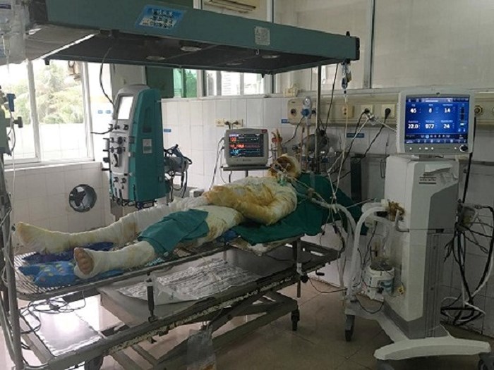 Bị bỏng nặng do sưởi ấm cụ ông tử vong